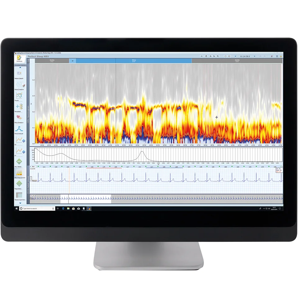 HRV software - MIOT