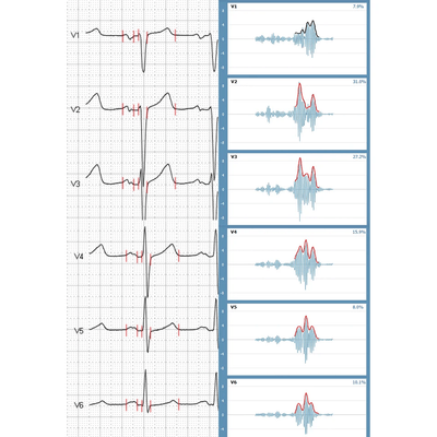 HyperQ software - MIOT HyperQ software - MIOT