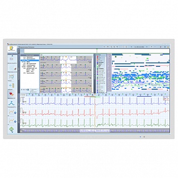 Система аналізу ЕКГ та AT за Холтером Medilog DARWIN2 - Фото 2